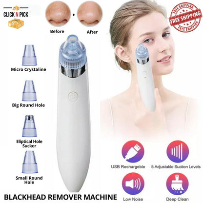 Derma Suction Blackheads Remover Device